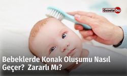 Bebeklerde Konak Oluşumu Nasıl Geçer? Zararlı Mı?