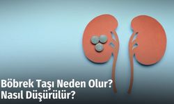 Böbrek Taşı Neden Olur? Nasıl Düşürülür?