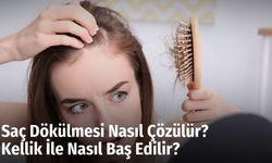 Saç Dökülmesi Nasıl Çözülür? Kellik İle Nasıl Baş Edilir?