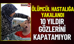 Ölümcül Hastalığa Yakalandı 10 Yıldır Gözlerini Kapatamıyor