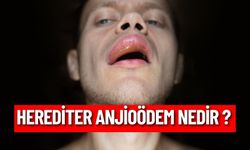 Herediter Anjioödem Nedir ? Nasıl Anlaşılır ?