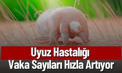 Uyuz Hastalığı Vaka Sayıları Hızla Artıyor