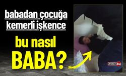 Bu Nasıl Baba? Çocuğuna Kemerle İşkence Etti!