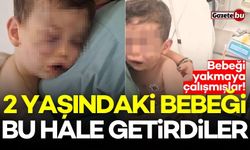 2 yaşındaki bebeği bu hale getirdiler! Caniler gözaltında