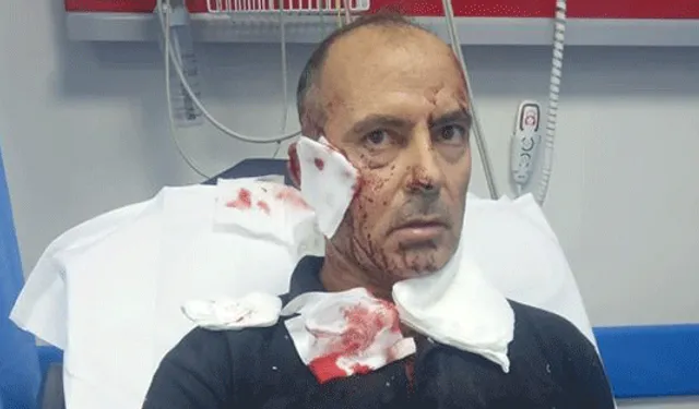 Bursa'da Köpek Saldırısı: 100'den Fazla Dikiş!