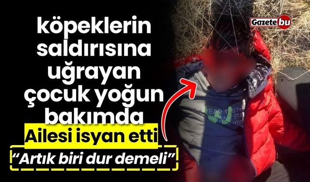 Köpeklerin saldırısına uğrayan çocuk yoğun bakımda