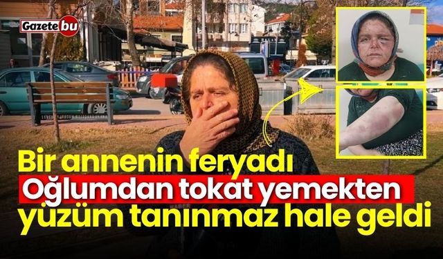 Bir annenin feryadı: Oğlumdan tokat yemekten yüzüm tanınmaz hale geldi