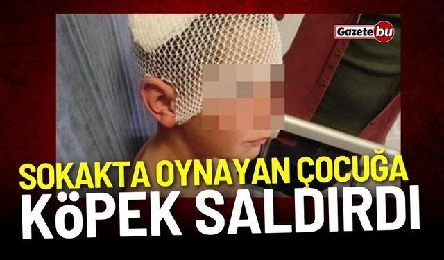 Sokakta oynayan çocuğa köpek saldırdı