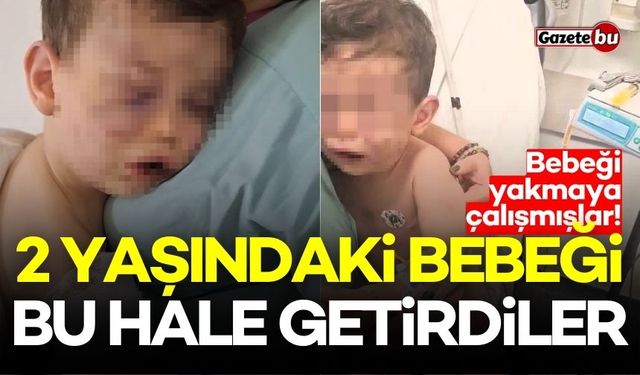 2 yaşındaki bebeği bu hale getirdiler! Caniler gözaltında