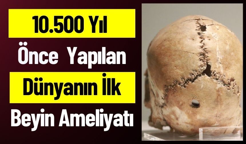 10.500 Yıl Önce  Yapılan Dünyanın İlk Beyin Ameliyatı