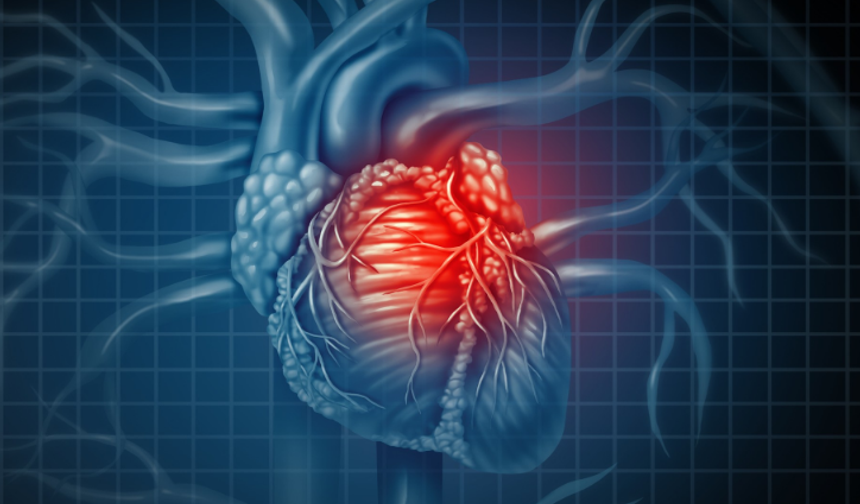 Aşırı sıcakların kalp krizine olan etkileri nelerdir?