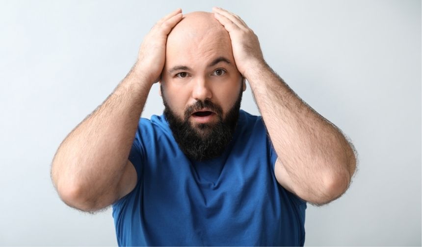 Saç Dökülmesi Nasıl Çözülür Kellik İle Nasıl Baş Edilir (2)