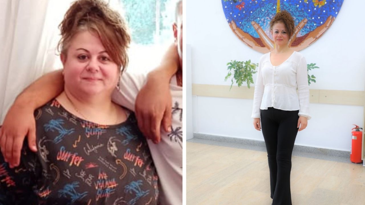 1.5 Yılda 50 Kilo Vererek Hayatını Değiştirdi! (1)