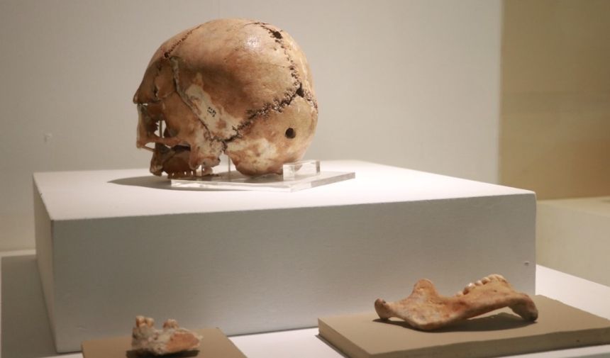 10.500 Yıl Önce Aksaray'da Yapılan Dünyanın İlk Beyin Ameliyatı (1)