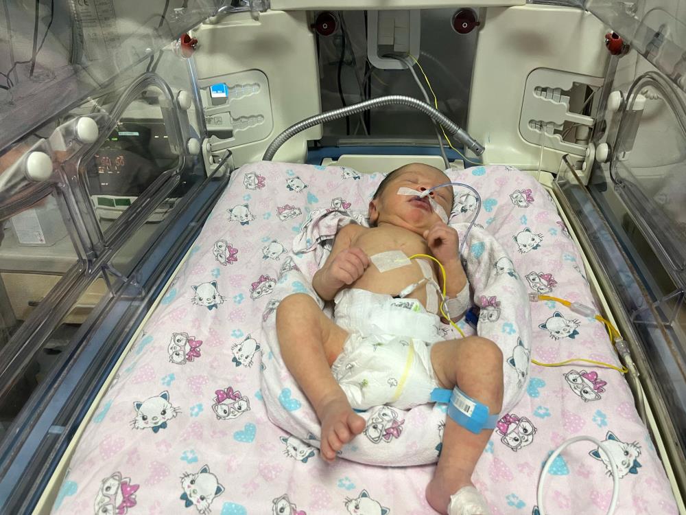 Annesi Kazada Ölüp Sezaryenle Dünyaya Gelen Bebek Hayata Tutundu (3)