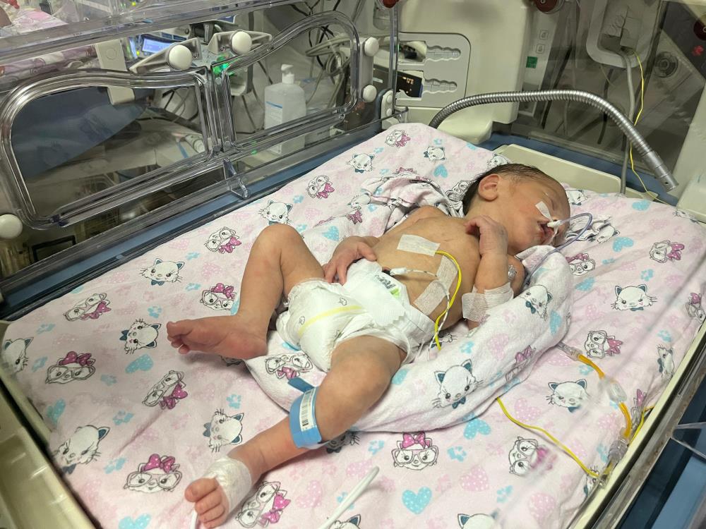 Annesi Kazada Ölüp Sezaryenle Dünyaya Gelen Bebek Hayata Tutundu (4)