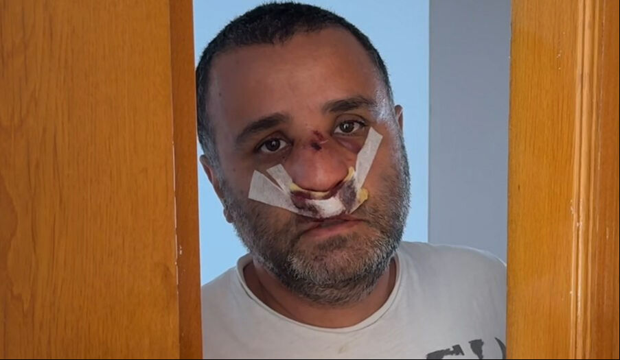 Marmarayda 2 Cocugunun Yaninda Yumruklanan Baba Konustu Bu Konuyu Sen Fisekledin 17486872174902 4